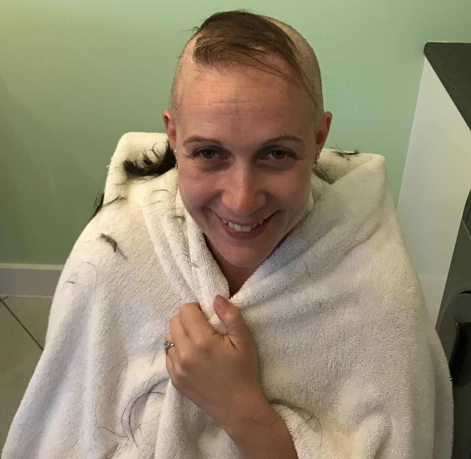 Emma Davies during treatment when she lost her hair